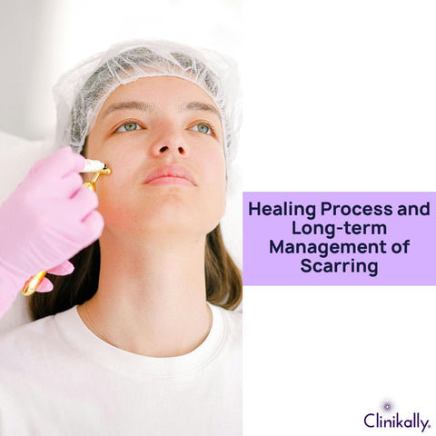 Healing Process and Long-term Management of Scarring