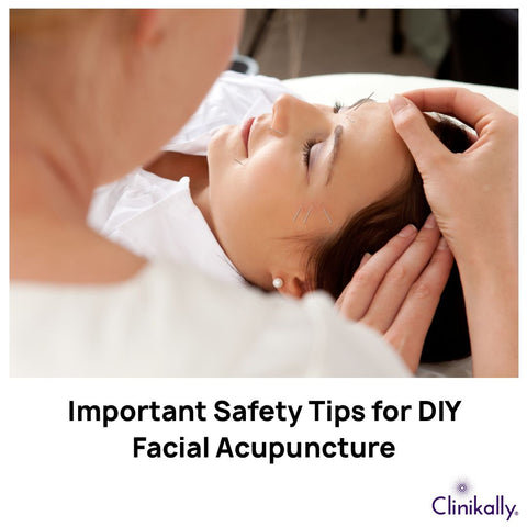 Important Safety Tips for DIY Facial Acupuncture