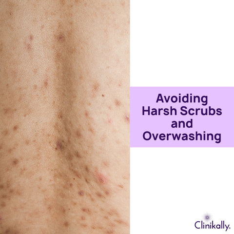 Avoiding Harsh Scrubs and Overwashing