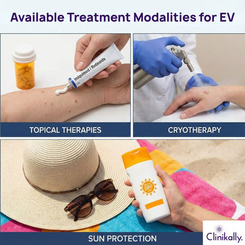 Available Treatment Modalities for EV
