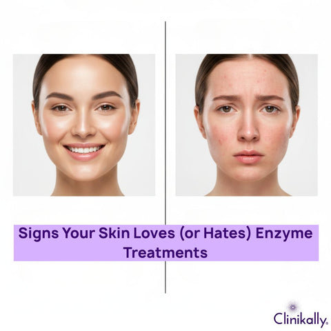 Signs Your Skin Loves (or Hates) Enzyme Treatments