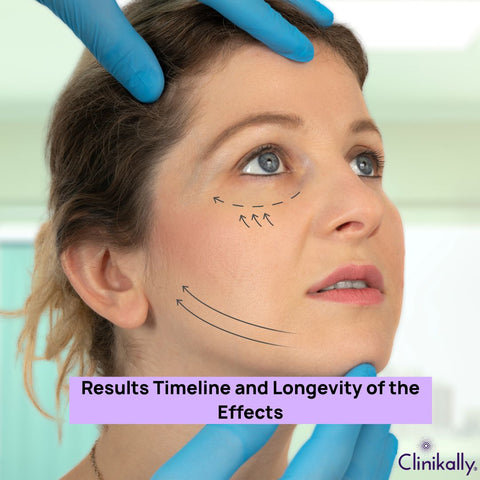 Results Timeline and Longevity of the Effects