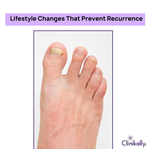 Lifestyle Changes That Prevent Recurrence
