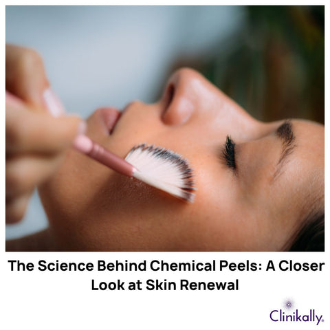 The Science Behind Chemical Peels: A Closer Look at Skin Renewal