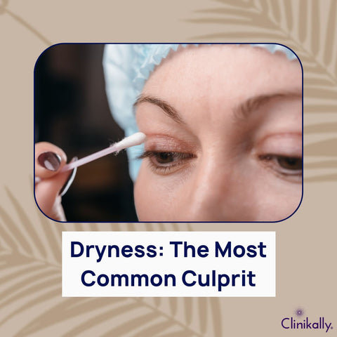Dryness: The Most Common Culprit