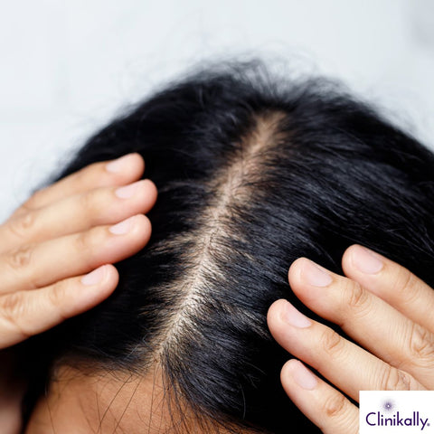 Chicory Protein for Elasticity, Scalp Health, and Breakage Control