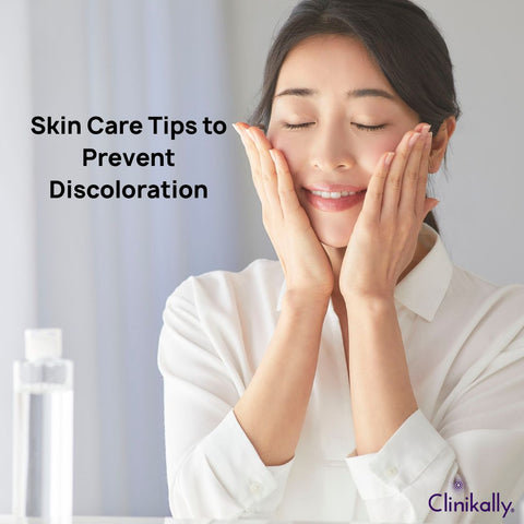 Skin Care Tips to Prevent Discoloration