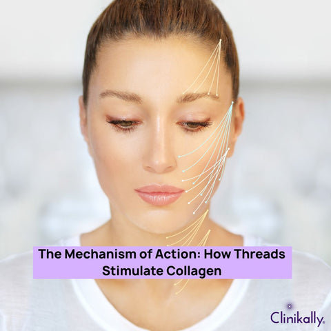 The Mechanism of Action: How Threads Stimulate Collagen