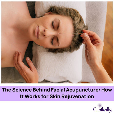 The Science Behind Facial Acupuncture: How It Works for Skin Rejuvenation
