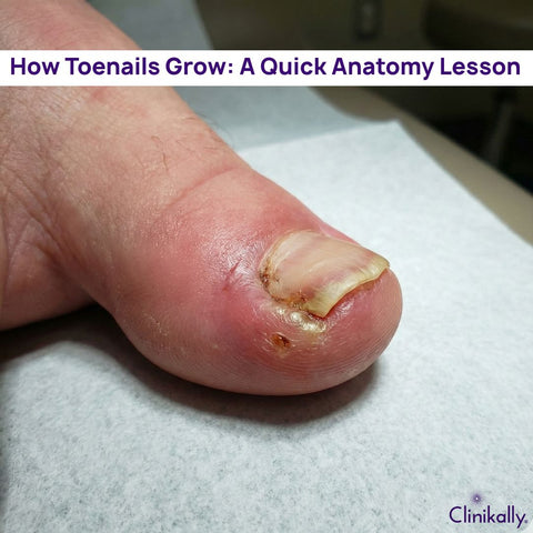 How Toenails Grow: A Quick Anatomy Lesson