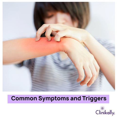 Common Symptoms and Triggers