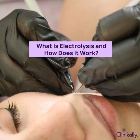 What Is Electrolysis and How Does It Work?