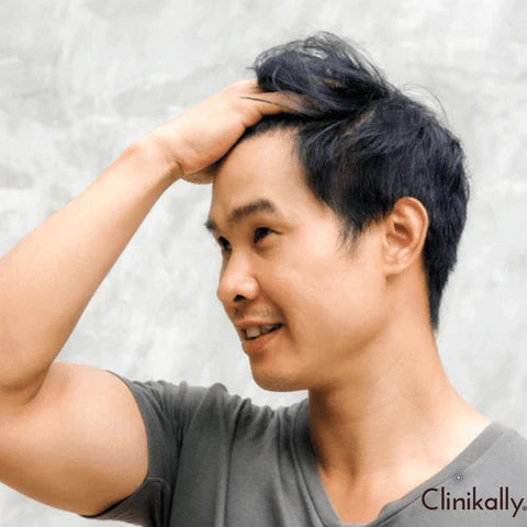 Benefits of Procapil hair serum