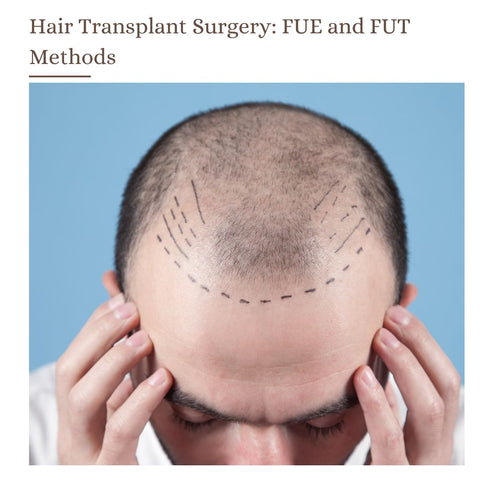 Hair Transplant Surgery: FUE and FUT Methods