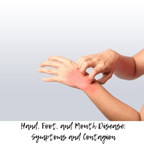 Hand, Foot, and Mouth Disease: Symptoms and Contagion