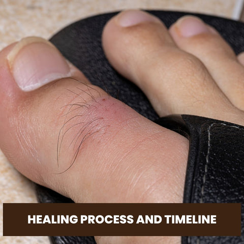 Healing Process and Timeline