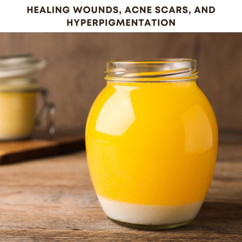 Healing Wounds, Acne Scars, and Hyperpigmentation
