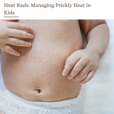 Heat Rash: Managing Prickly Heat in Kids