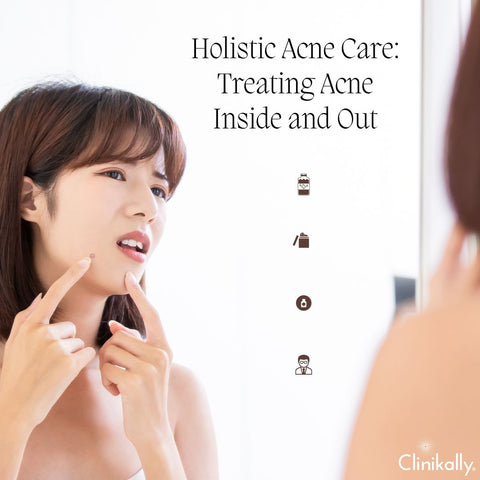 Holistic Acne Care: Treating Acne Inside and Out