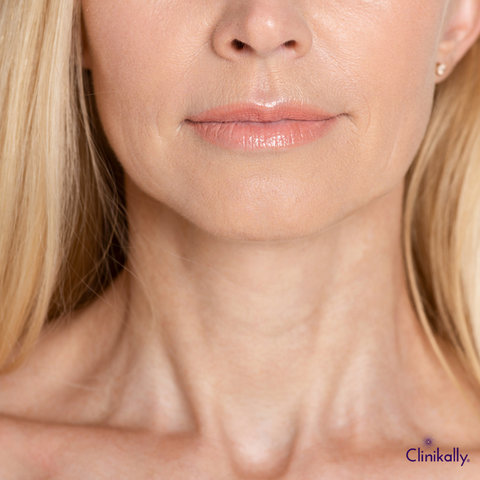 What is Elastin and How Does it Affect Your Skin?