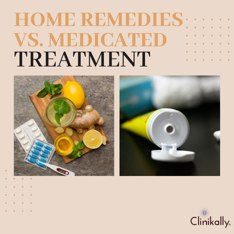 Home remedies vs. medicated treatments