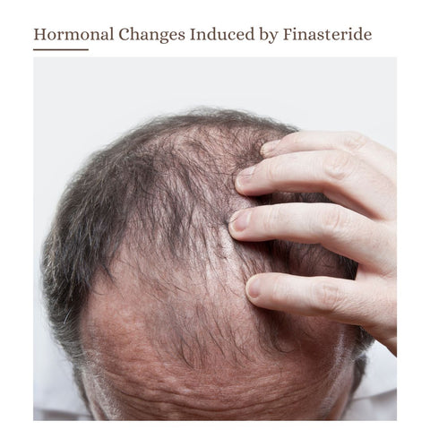 Hormonal Changes Induced by Finasteride