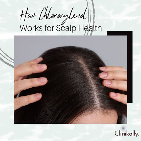 How Chloroxylenol Works for Scalp Health