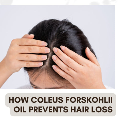 How Coleus Forskohlii Oil Prevents Hair Loss