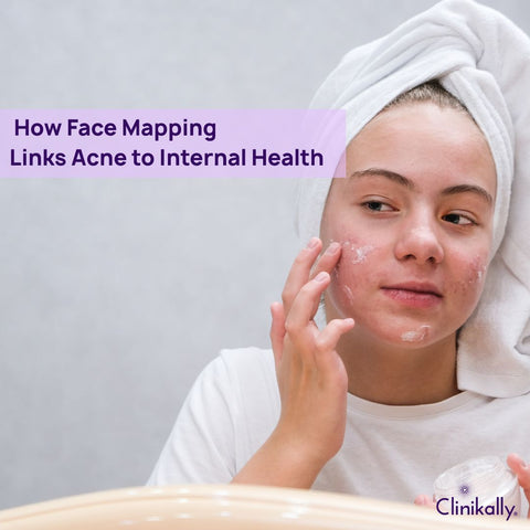 How Face Mapping Links Acne to Internal Health