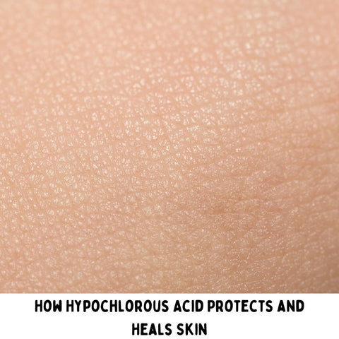 How Hypochlorous Acid Protects and Heals Skin