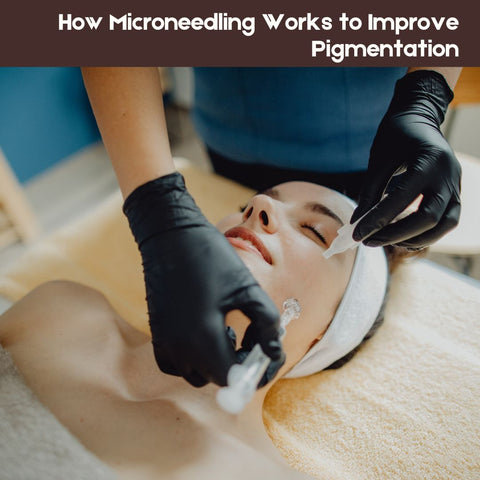 How Microneedling Works to Improve Pigmentation