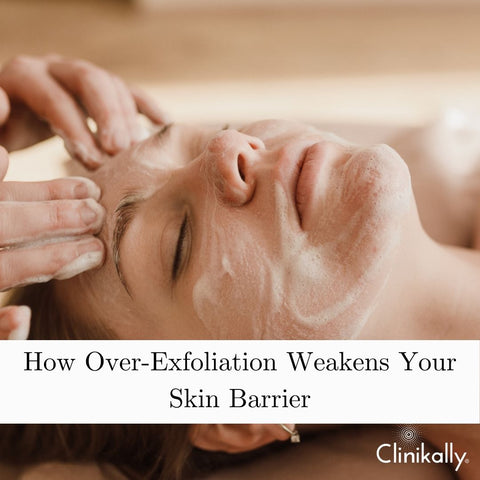 How Over-Exfoliation Weakens Your Skin Barrier