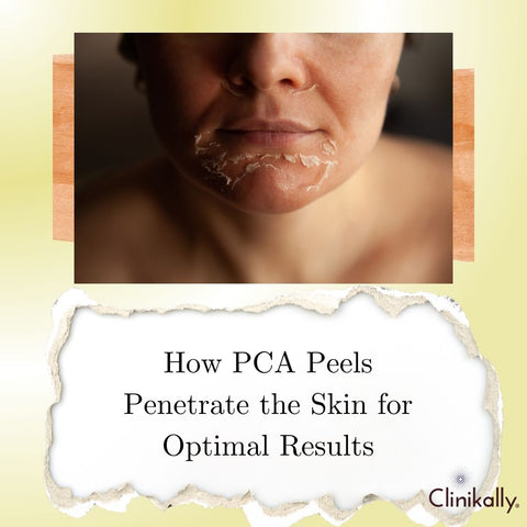 How PCA Peels Penetrate the Skin for Optimal Results