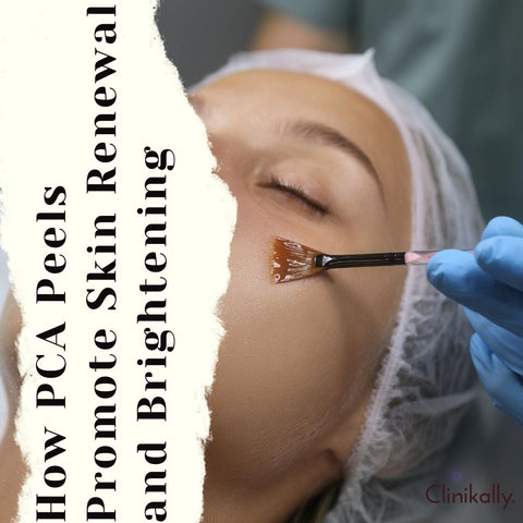 How PCA Peels Promote Skin Renewal and Brightening