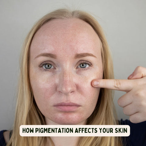 How Pigmentation Affects Your Skin