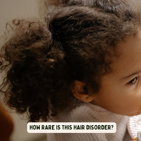 How Rare Is This Hair Disorder?