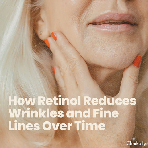 How Retinol Reduces Wrinkles and Fine Lines Over Time