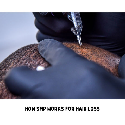 How SMP Works for Hair Loss