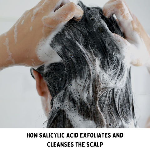 How Salicylic Acid Exfoliates and Cleanses the Scalp