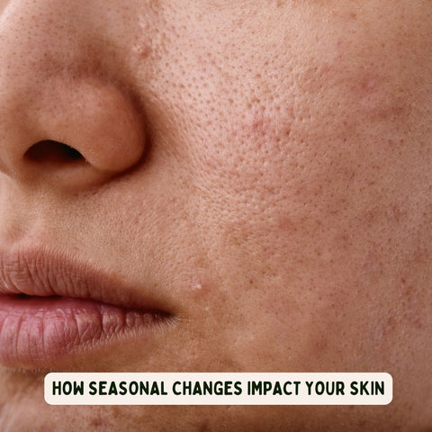 How Seasonal Changes Impact Your Skin