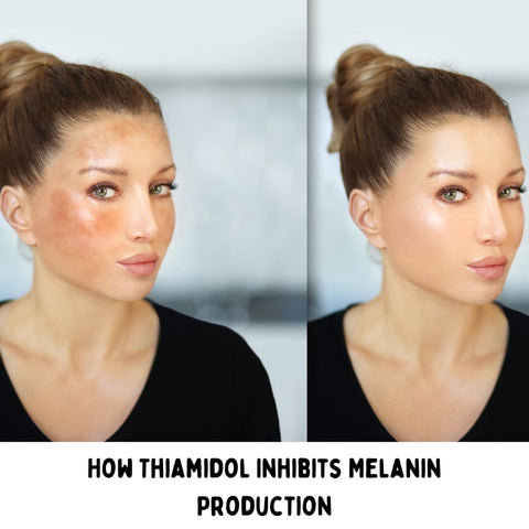 How Thiamidol Inhibits Melanin Production