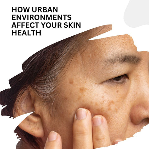 How Urban Environments Affect Your Skin Health