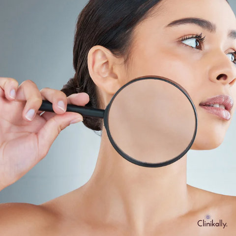 Benefits of Niacinamide For Your Skin