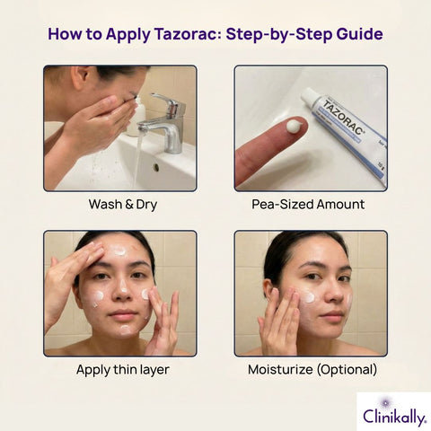 How to Apply Tazorac