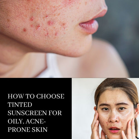How to Choose Tinted Sunscreen for Oily, Acne-Prone Skin