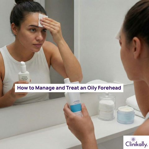How to Manage and Treat an Oily Forehead