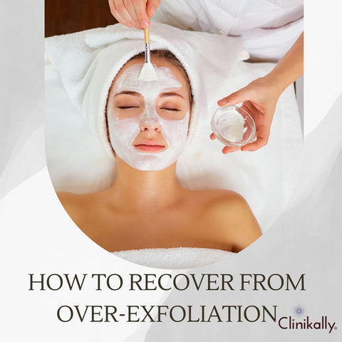 How to Recover from Over-Exfoliation