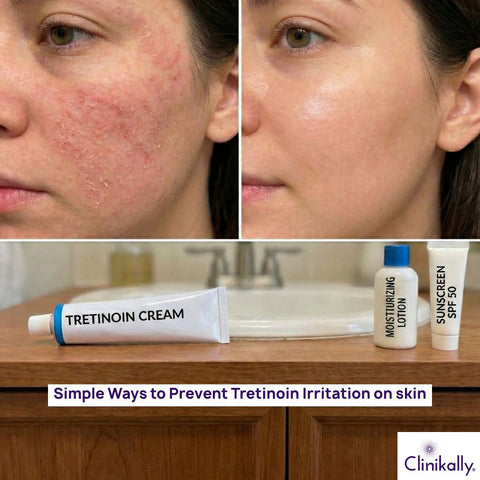 How to Reduce Tretinoin Irritation in Winter