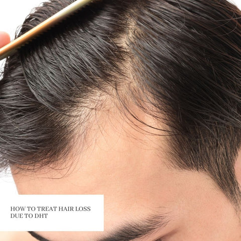 How to Treat Hair Loss Due to DHT