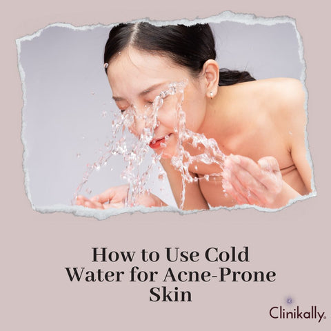 How to Use Cold Water for Acne-Prone Skin